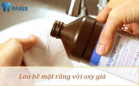 Lau bề mặt răng với oxy già - Cách làm đơn giản, dễ thực hiện