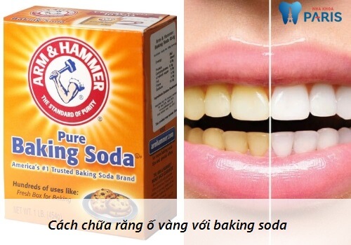 cách làm trắng răng bị vàng với baking soda