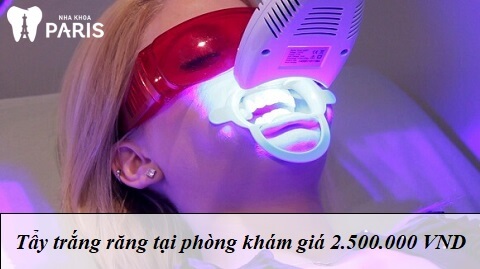 [Tìm hiểu ngay] Giá tẩy trắng răng tại Hà Nội bao nhiêu tiền?