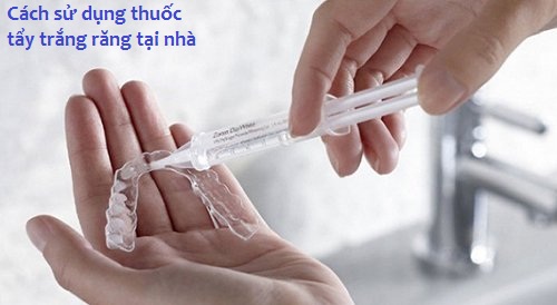 Cách sử dụng thuốc tẩy trắng răng tại nhà kết hợp với máng tẩy trắng