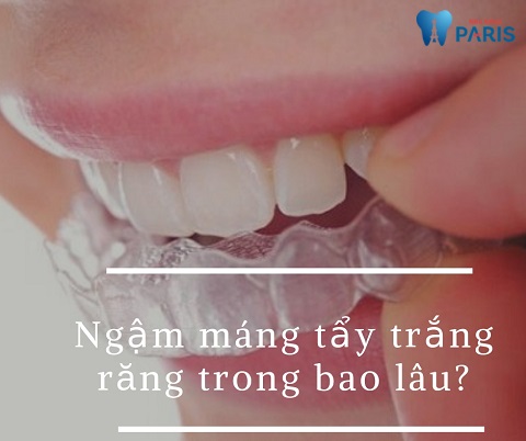 Có thể làm tẩy trắng răng tự nhiên mà không cần máng tẩy không?
