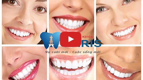 Video tẩy trắng răng bằng công nghệ WhiteMax