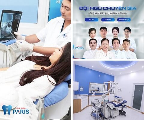 Mách bạn: Tẩy trắng răng ở đâu TỐT – AN TOÀN – HIỆU QUẢ?