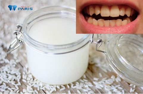 Cách làm trắng răng bằng nước vo gạo chỉ phù hợp với tình trạng răng bị ố vàng, xỉn màu nhẹ. 