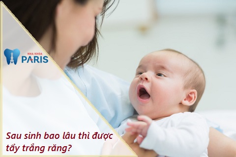 [Nha khoa Paris tư vấn] Sau sinh bao lâu thì được tẩy trắng răng?