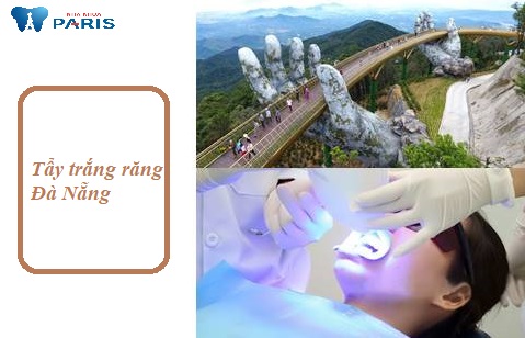 Chia sẻ Địa chỉ Tẩy trắng răng Đà Nẵng An Toàn – Không mòn men