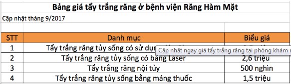 Bảng giá tẩy trắng răng ở bệnh viện răng hàm mặt TRung Ương