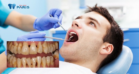 Điều trị triệt để bệnh lý là việc làm tiên quyết để đảm bảo được chức năng ăn nhai đồng thời tính thẩm mỹ cho răng miệng. 